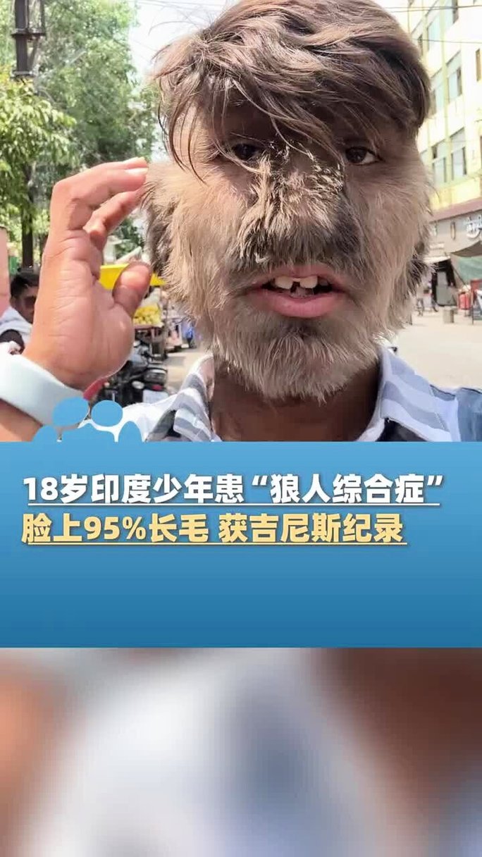 久久精品激情片的相关介绍